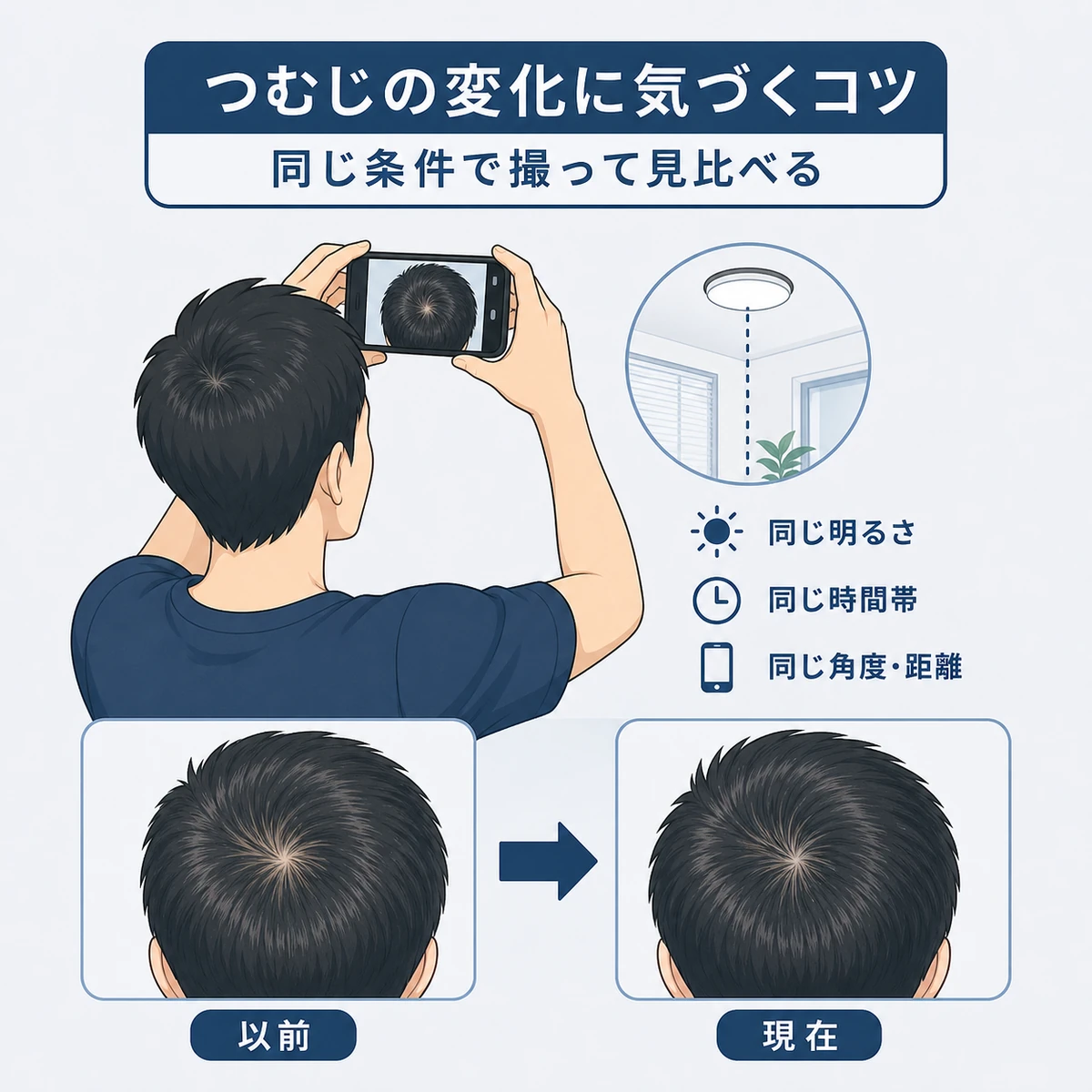 成人男性が自分の頭頂部をスマートフォンで撮影し、以前と現在の写真を見比べる様子を表した医療イラスト