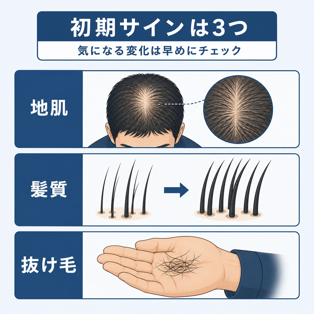 つむじはげの初期に現れる地肌の透けと髪質の変化と抜け毛の3つのサインを並べた医療イラスト