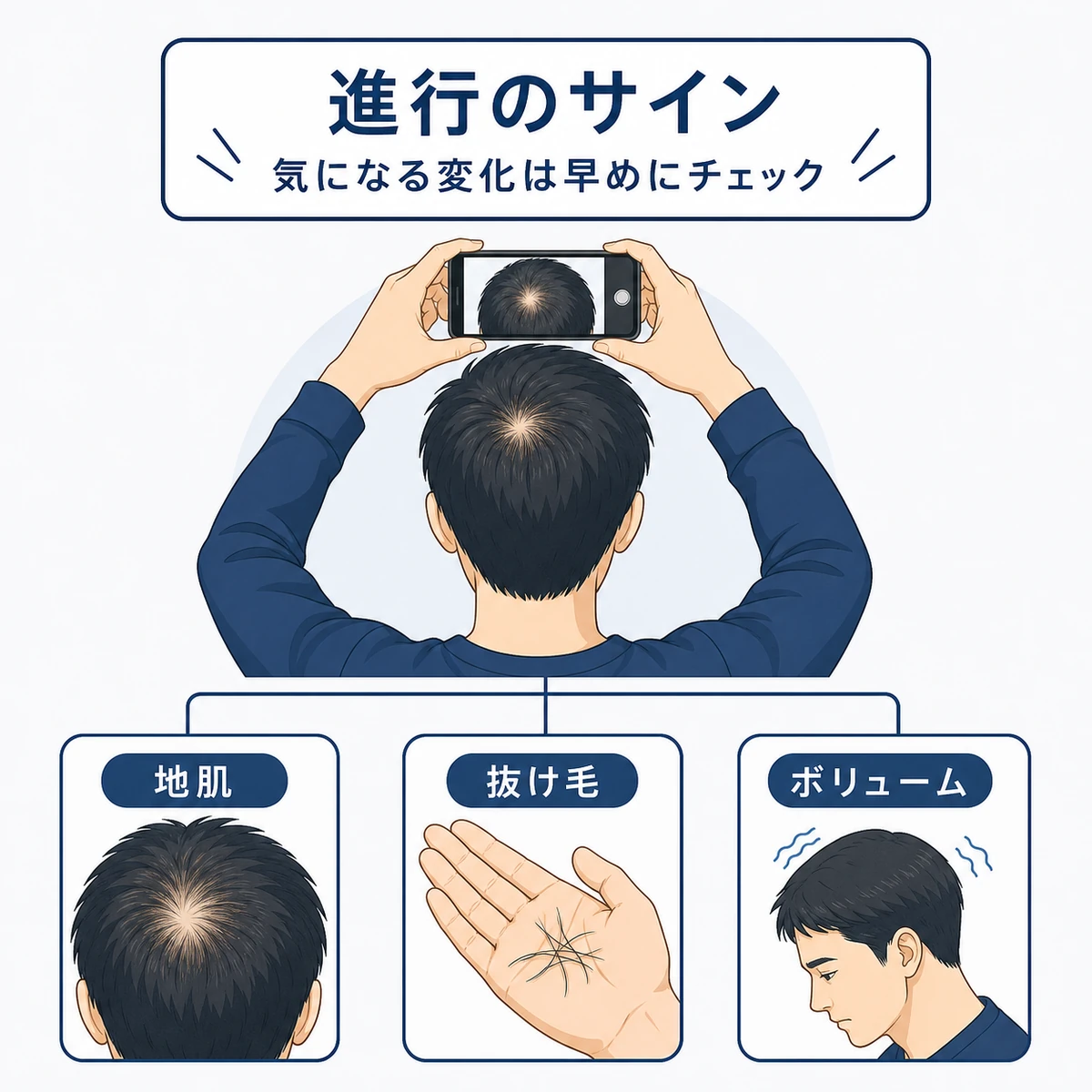 頭頂部の地肌や抜け毛の変化など進行のサインをチェックする成人男性の医療イラスト
