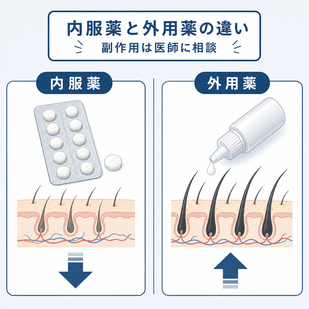 内服薬と外用薬それぞれの働きの違いを左右で対比して表した医療イラスト