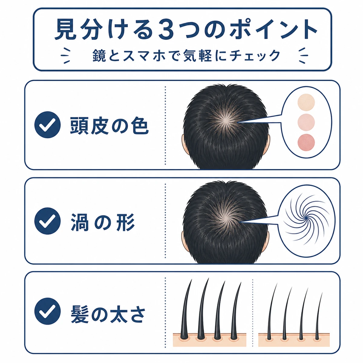 頭皮の色と渦の形と髪の太さでつむじを見分ける3つのチェック項目を並べた医療イラスト