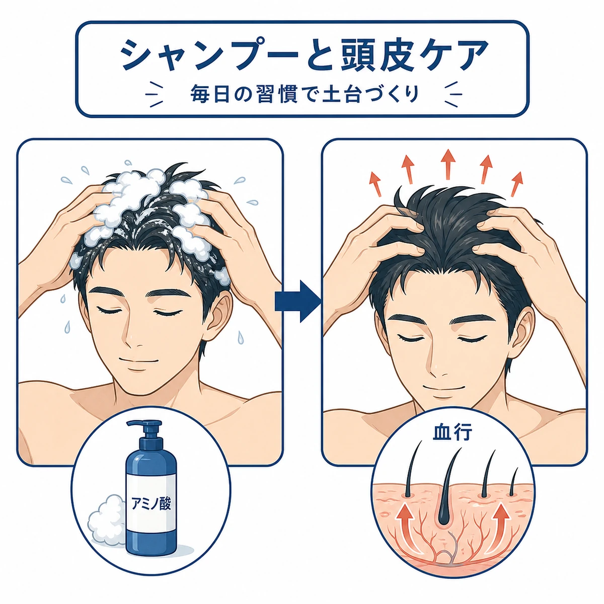 成人男性がアミノ酸系シャンプーと頭皮マッサージで頭皮を整える流れを示した医療イラスト