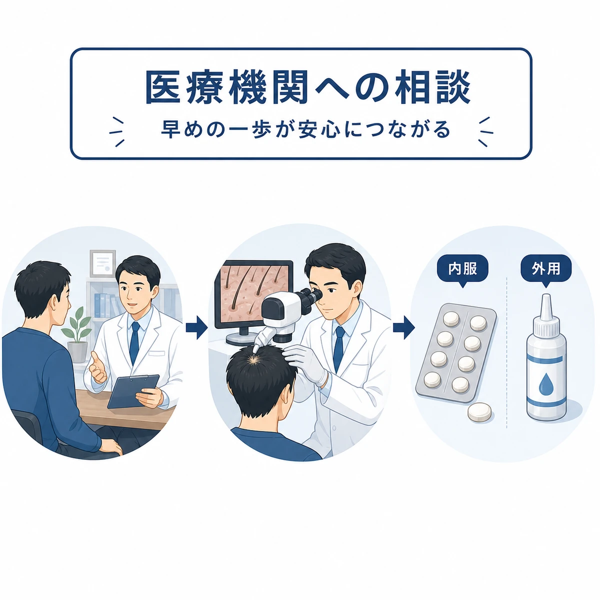 成人男性が医療機関でつむじはげを相談し診察から治療へ進む流れを示した医療イラスト