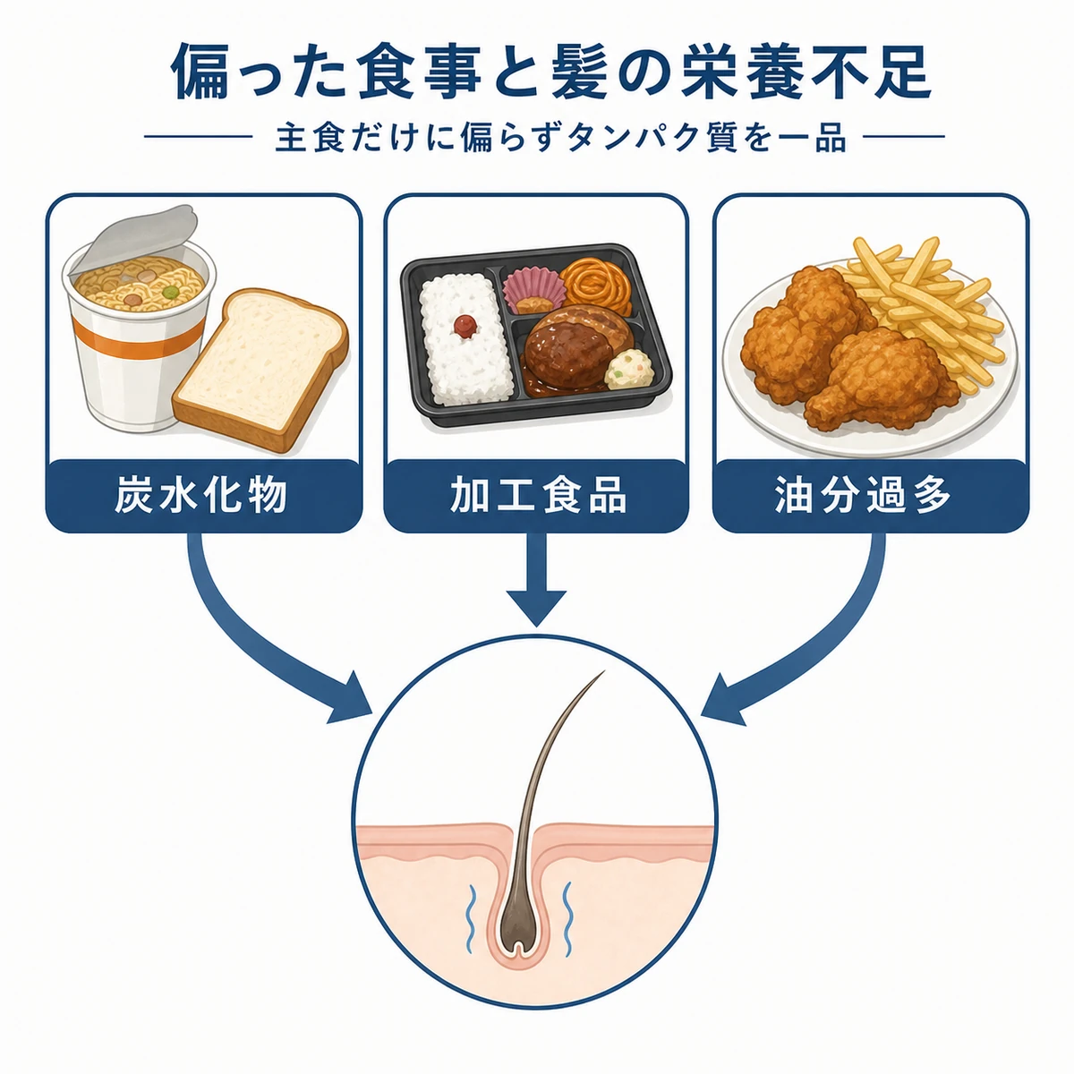 炭水化物や加工食品に偏った食事が髪の栄養不足を招く様子を表した医療イラスト
