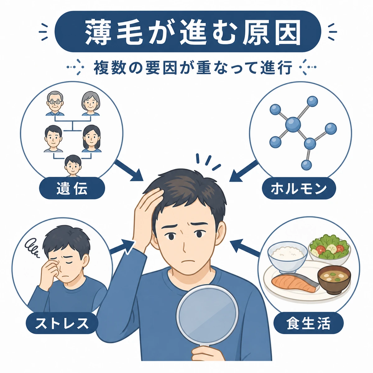 遺伝やホルモン、ストレス、食生活が薄毛に影響し合う関係を表した医療イラスト
