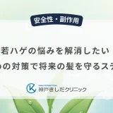若ハゲの悩みを解消したい!早めの対策で将来の髪を守るステップ