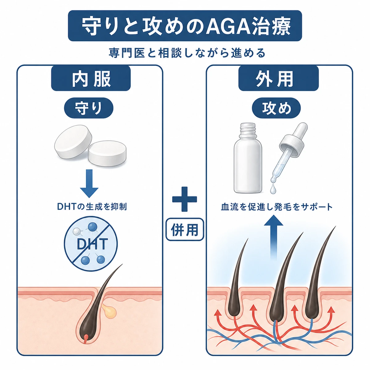 抜け毛を抑える内服薬と発毛を促す外用薬を対比したAGA治療の医療イラスト