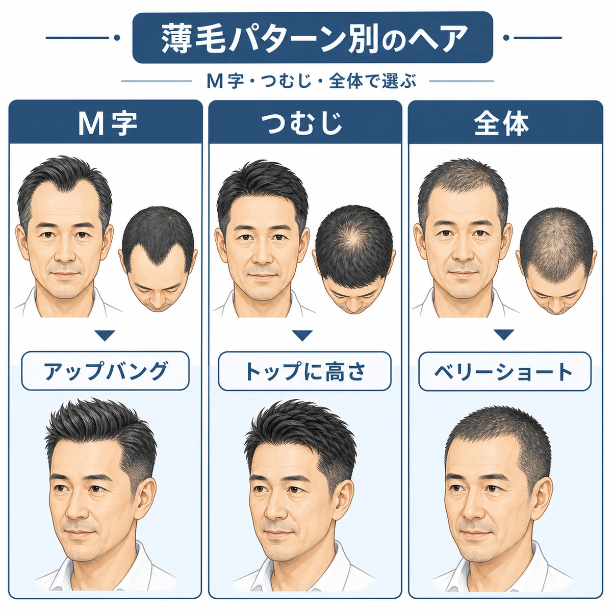50代男性の薄毛パターン別におすすめの髪型を3タイプで対比した解説イラスト