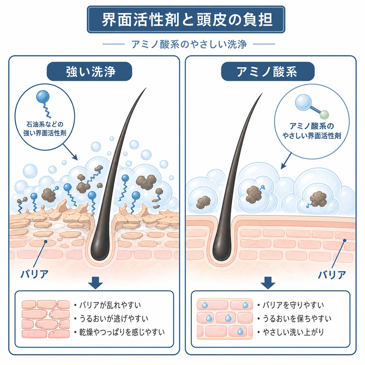強い界面活性剤とアミノ酸系の頭皮への負担の違いを対比した医療イラスト