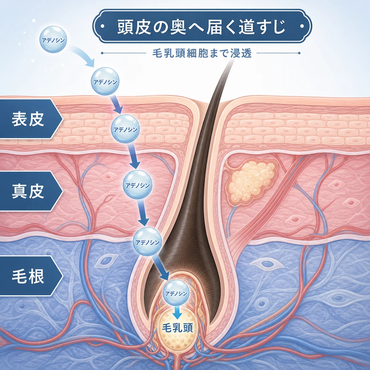 アデノシンが頭皮の表皮と真皮を通り毛乳頭細胞へ届く道すじを表した医療イラスト