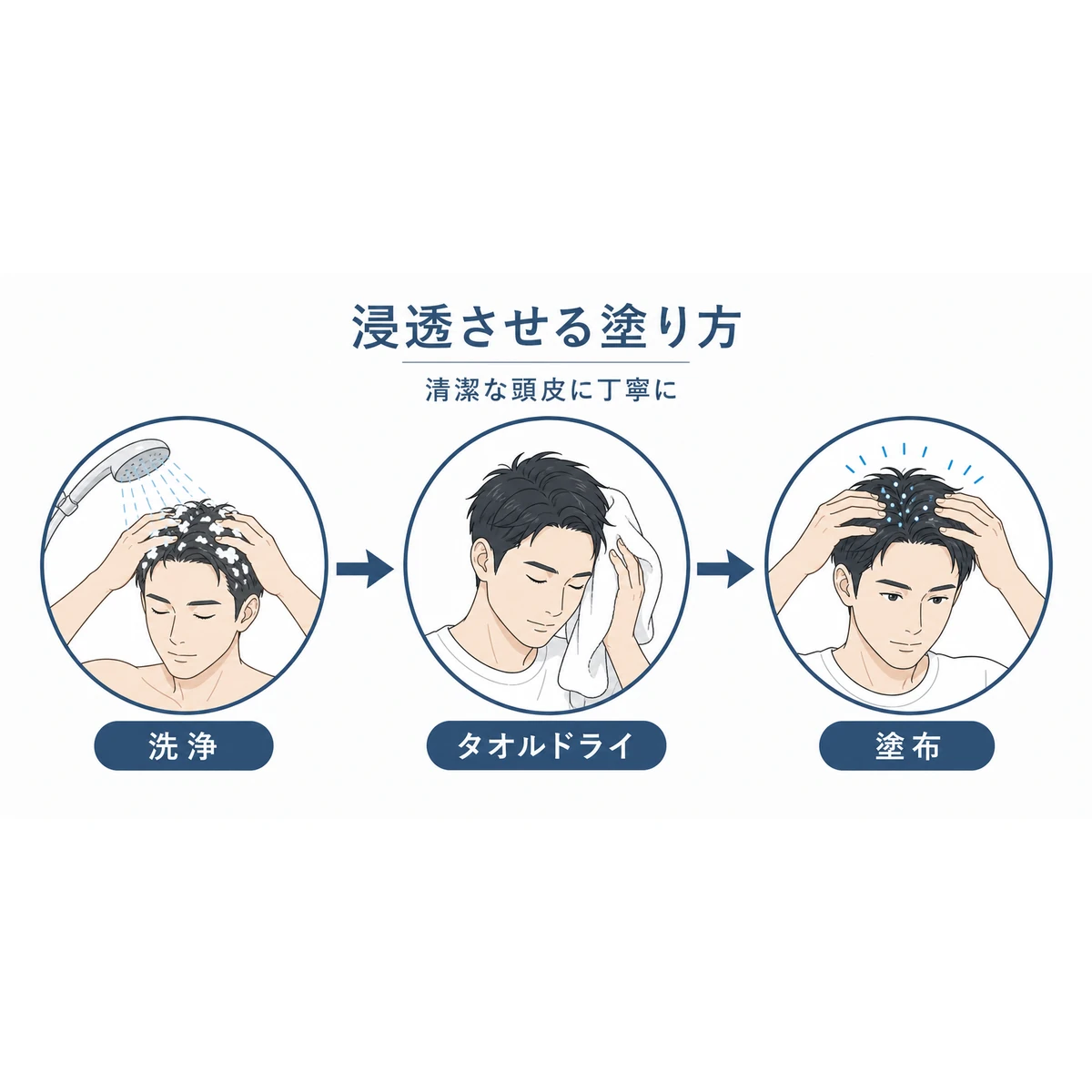 洗髪後の頭皮に育毛剤を塗るまでの三段階の流れを表した医療イラスト