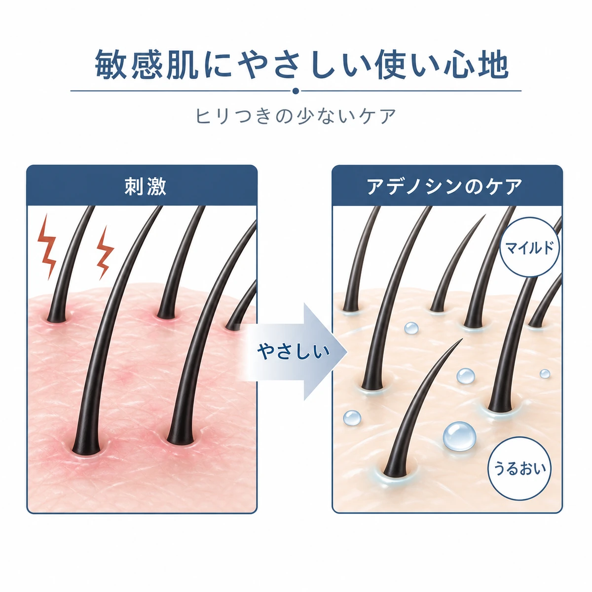 敏感肌でもマイルドに使えるアデノシンと刺激の強い成分を比べた医療イラスト