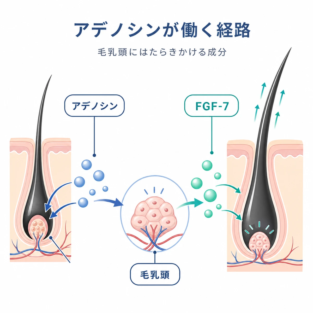 アデノシンが毛乳頭にはたらきかけFGF-7を増やす経路を示した医療イラスト