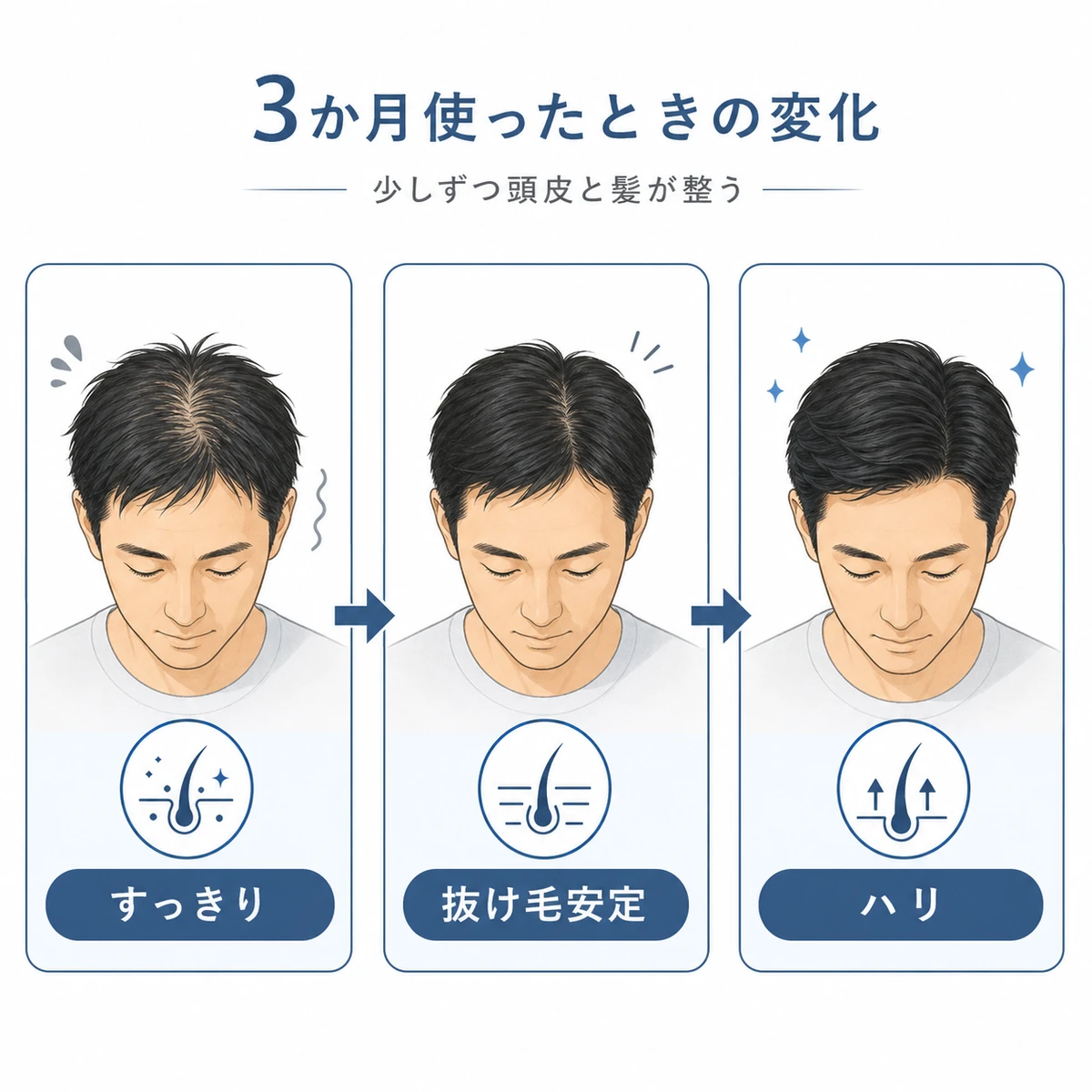 使用1か月から3か月にかけての頭皮と髪の変化を段階で表した医療イラスト