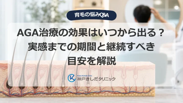 AGA治療の効果はいつから出る？実感までの期間と継続すべき目安を解説
