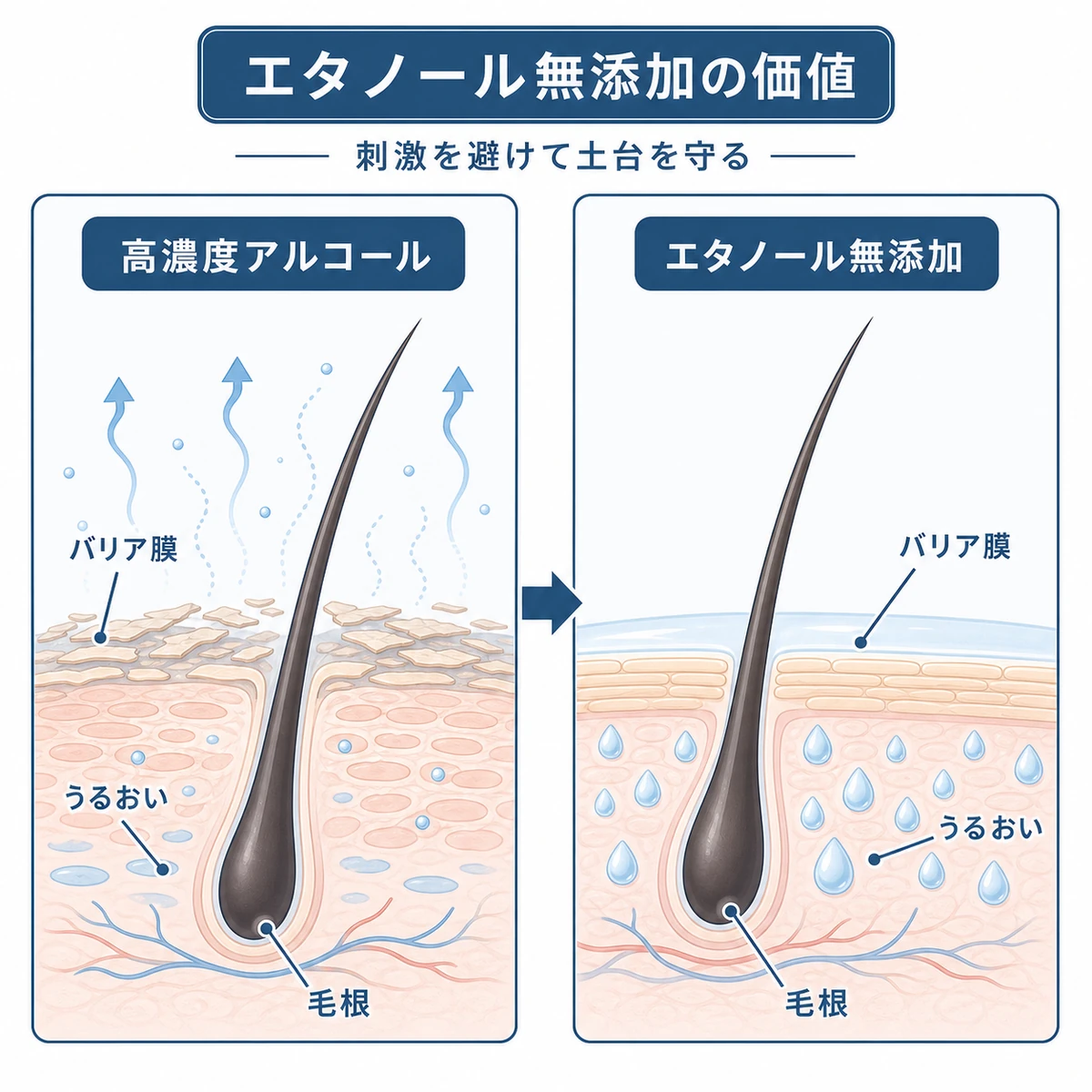エタノール無添加が頭皮のバリア機能とうるおいを守る仕組みを対比で表した医療イラスト