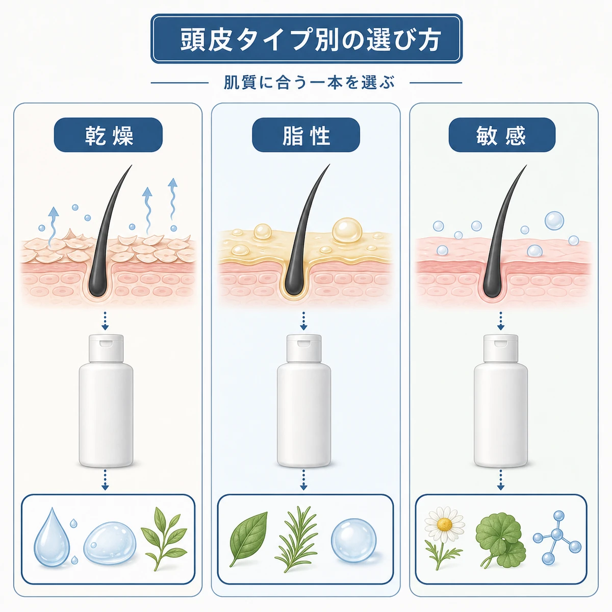 乾燥肌・脂性肌・敏感肌それぞれに合う無添加育毛剤の選び方を分類で示した医療イラスト