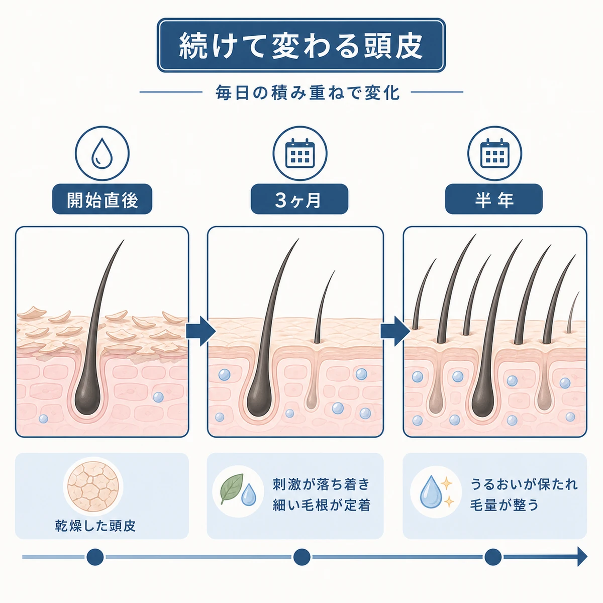 無添加ケアを続けた頭皮環境の変化を時系列で表した医療イラスト
