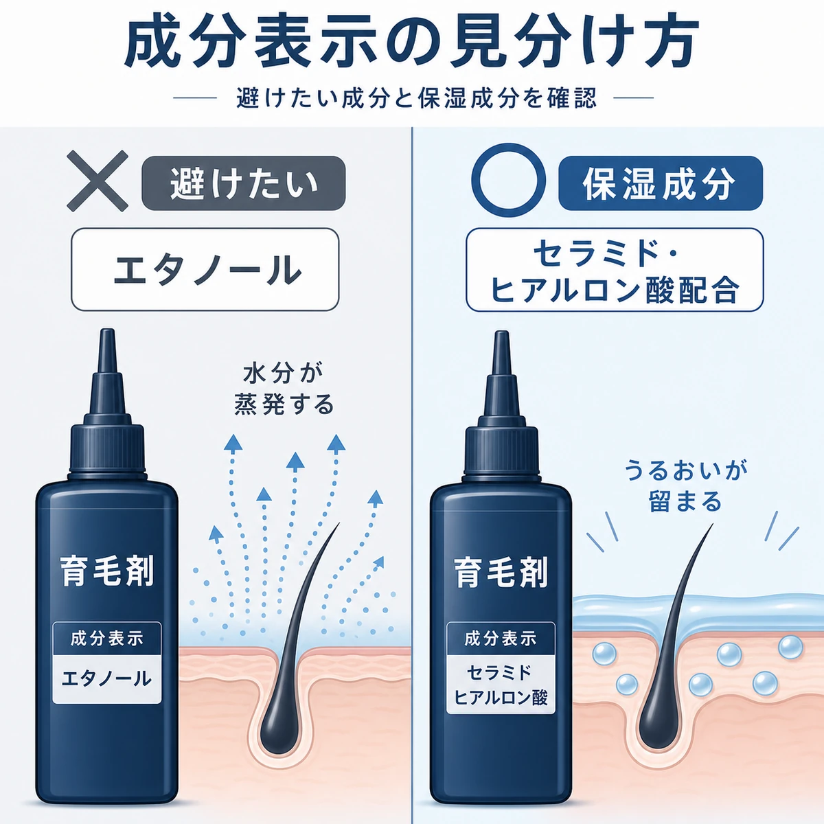 頭皮に刺激となるエタノールと保湿成分を成分表示で見分けるポイントを比較した医療イラスト