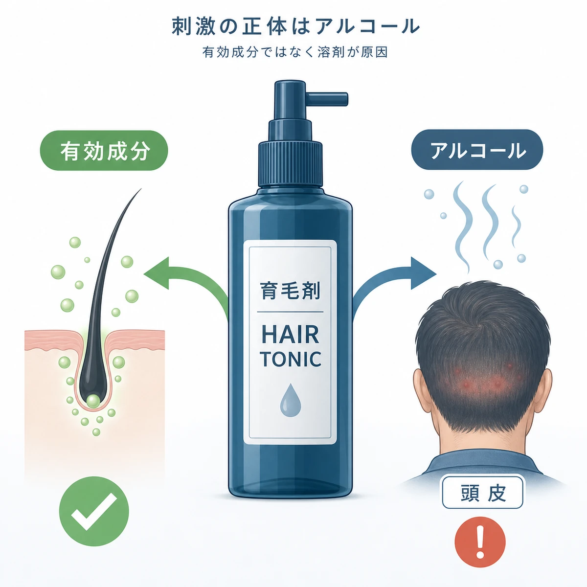 育毛剤の刺激の原因が有効成分ではなく基剤のアルコールであることを表した医療イラスト