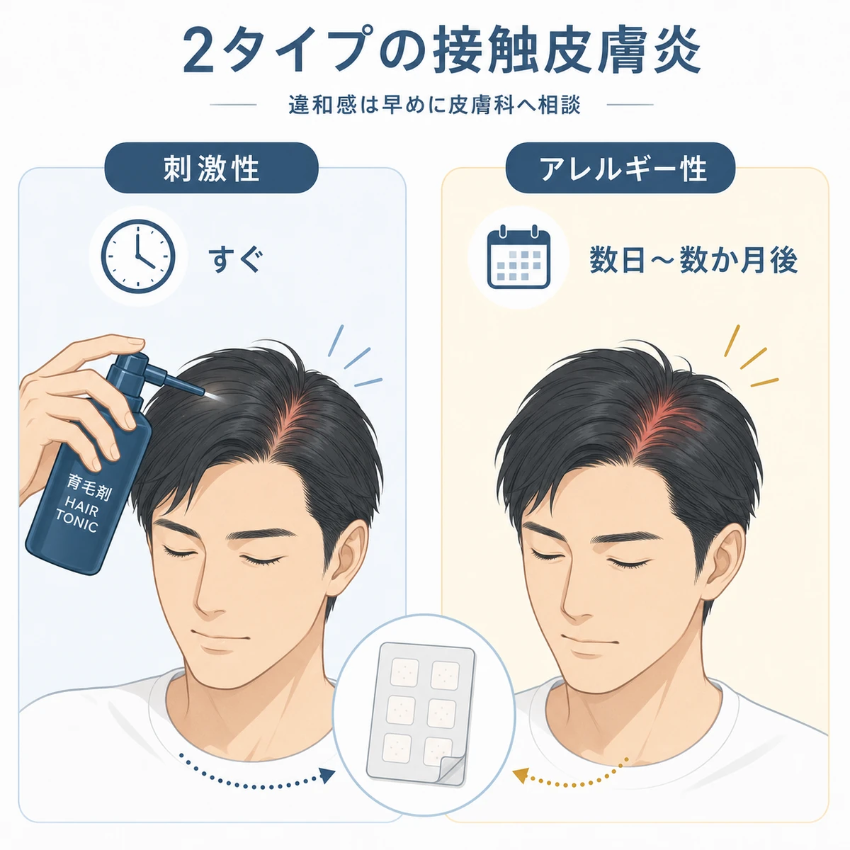 刺激性とアレルギー性の接触皮膚炎の違いを左右で比べた医療イラスト
