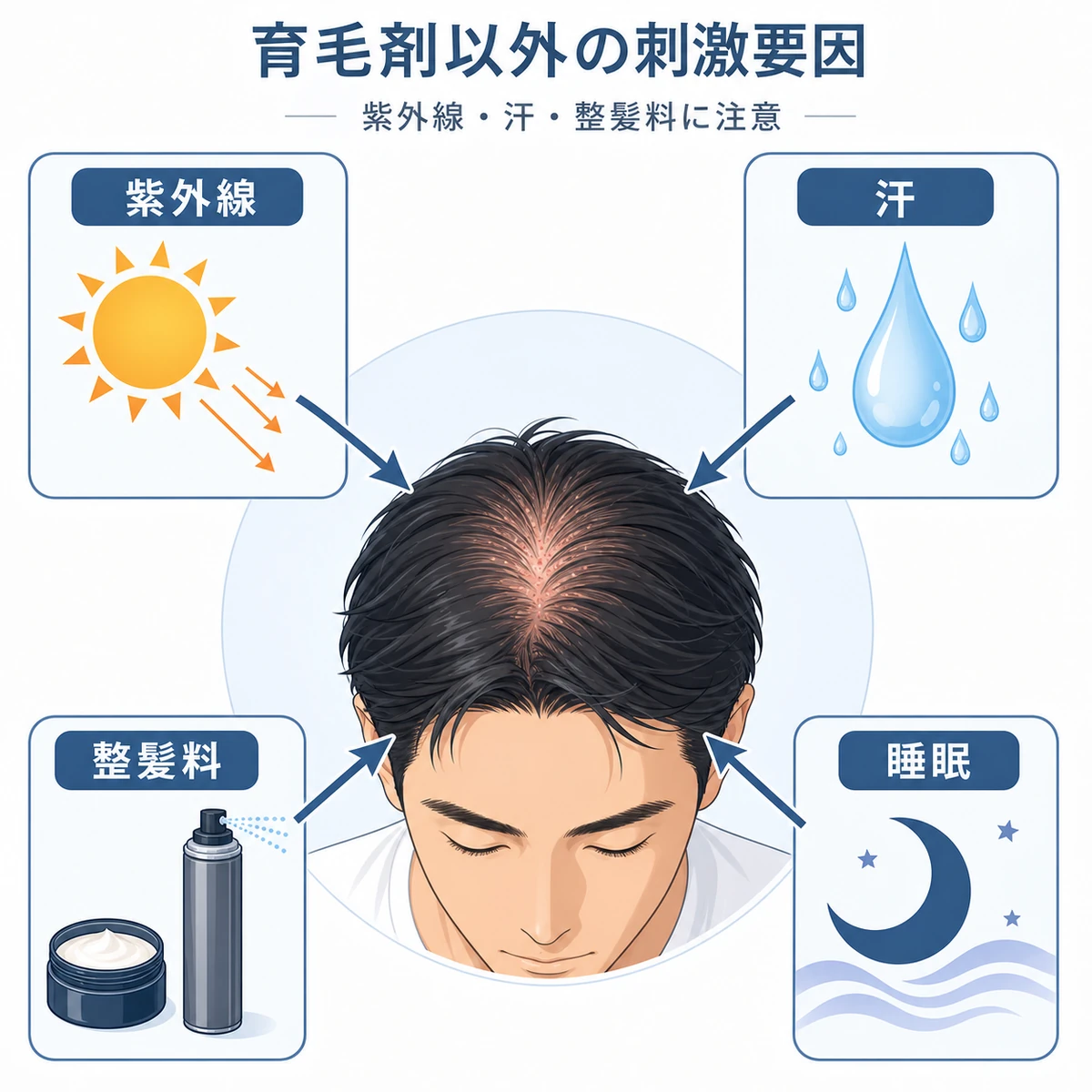 紫外線や汗や整髪料など育毛剤以外に頭皮を刺激する要因を頭部の周りに並べた医療イラスト