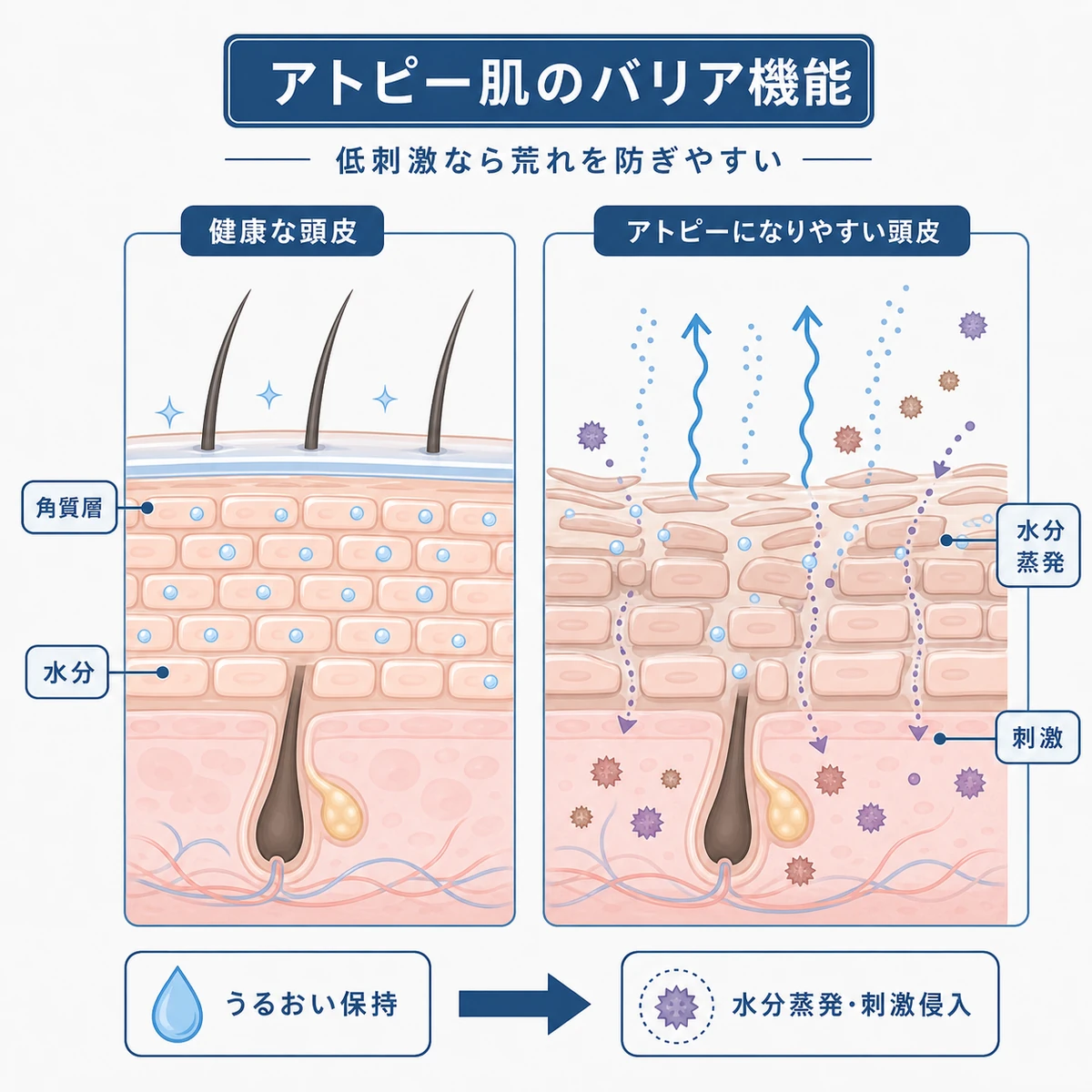アトピー肌と健やかな頭皮のバリア機能の違いを断面図で対比した医療イラスト