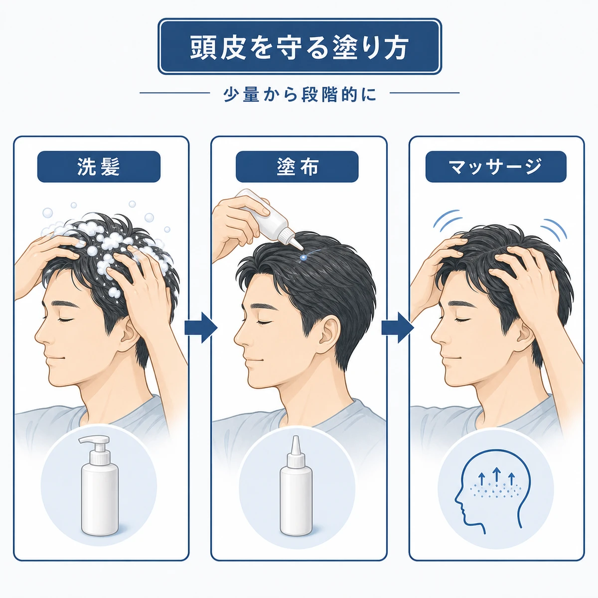 育毛剤を頭皮にやさしく塗る正しい手順を段階的に表した医療イラスト
