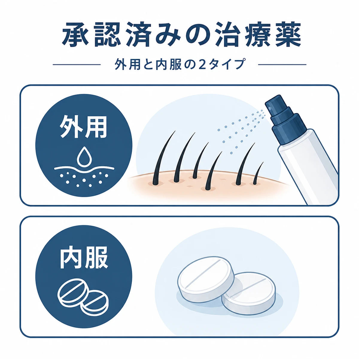 AGA治療で承認された外用薬と内服薬を投与経路で分類した医療イラスト