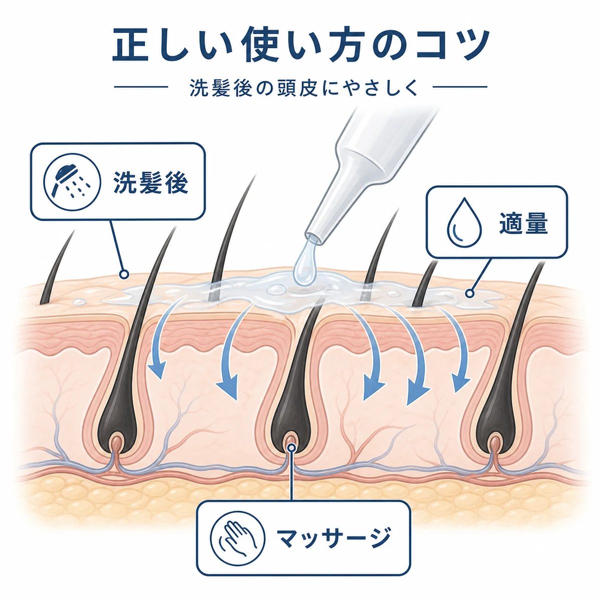 洗髪後の頭皮の断面にキャピキシルが浸透していく正しい使い方を表した医療イラスト