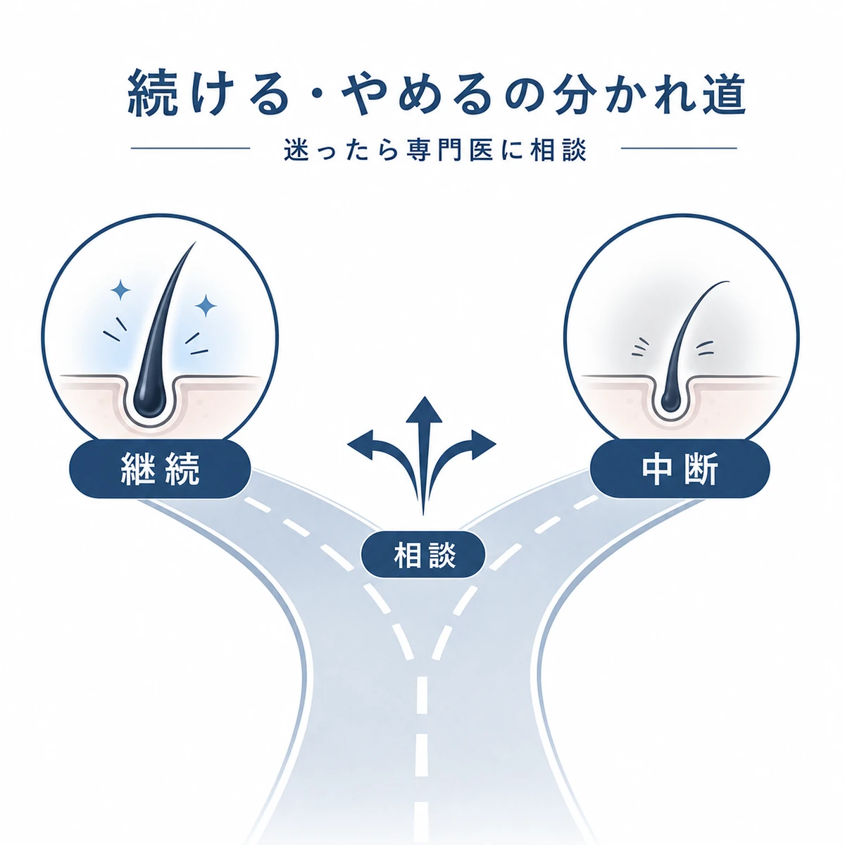 キャピキシルを継続する道と中断する道の分かれ道を表した医療イラスト