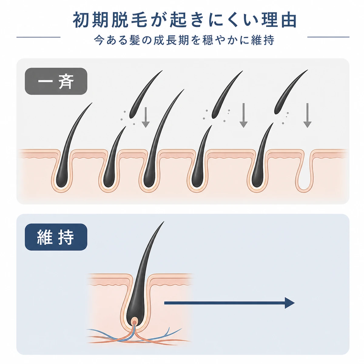 強制的な生え変わりと穏やかな維持を上下で比べた初期脱毛の起きにくさを表した医療イラスト