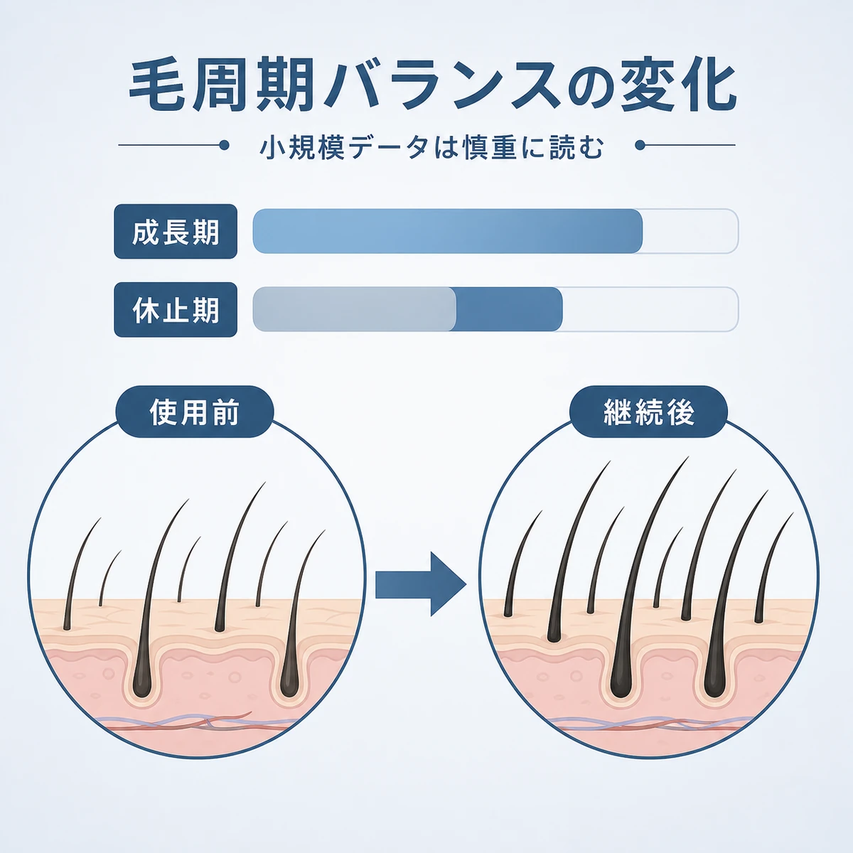 キャピキシルによる成長期と休止期の毛周期バランスの変化を矢印で表した育毛イラスト