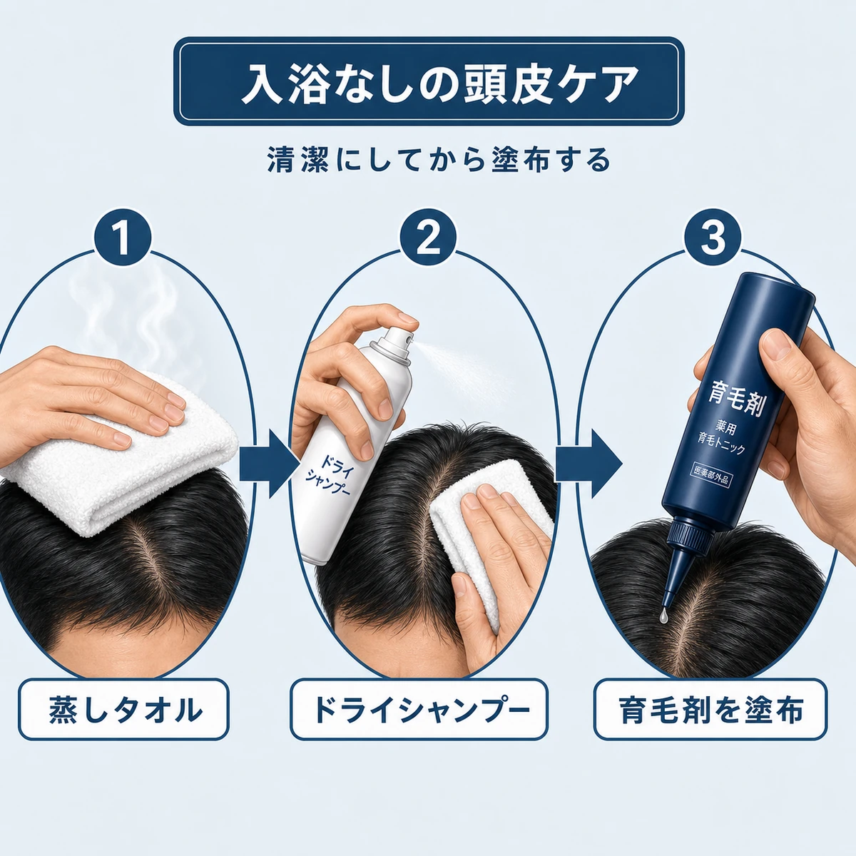 蒸しタオルとドライシャンプーで清潔にしてから育毛剤を塗る頭皮ケアの手順を表した医療イラスト