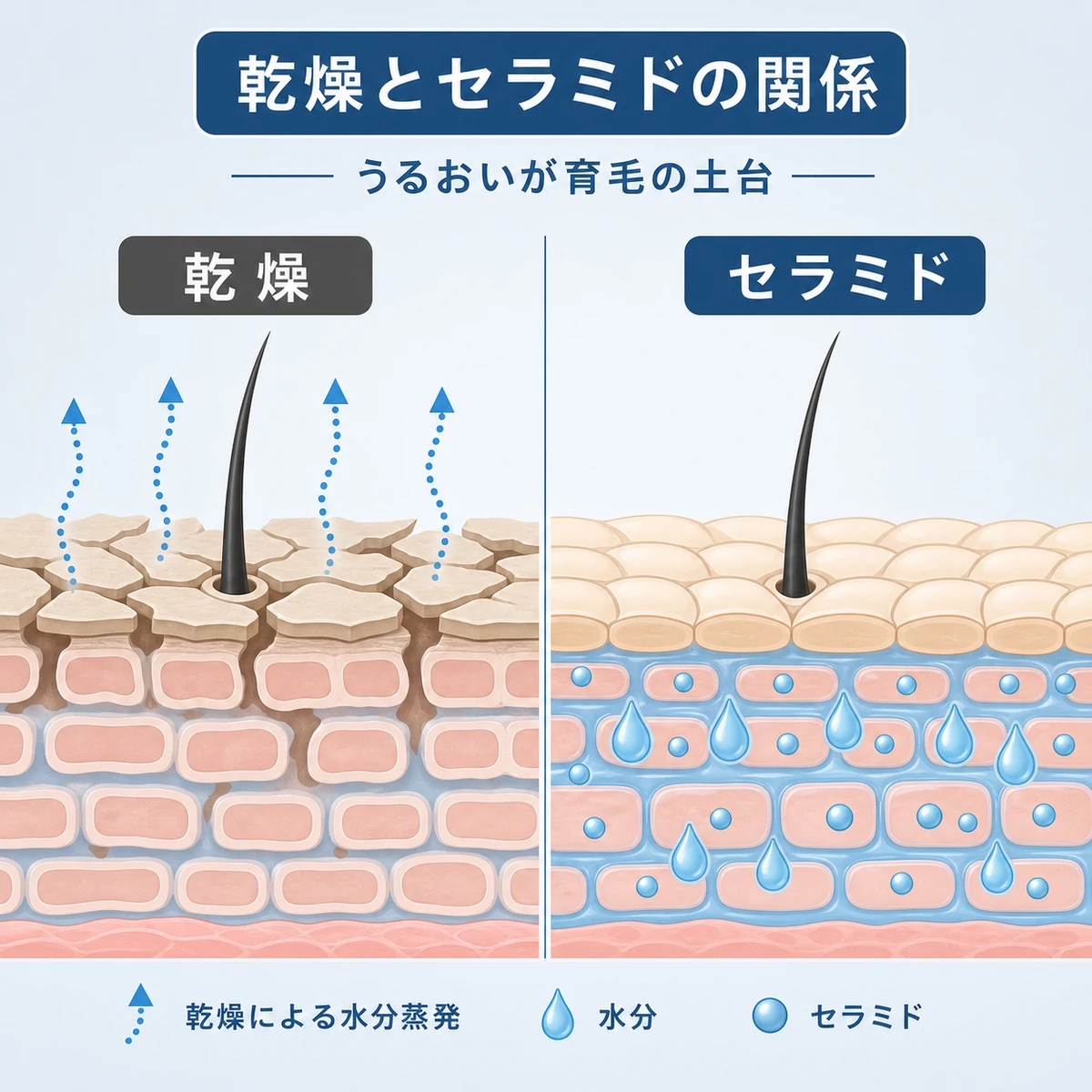 乾燥した頭皮とセラミドで潤った頭皮を左右で比べた医療イラスト