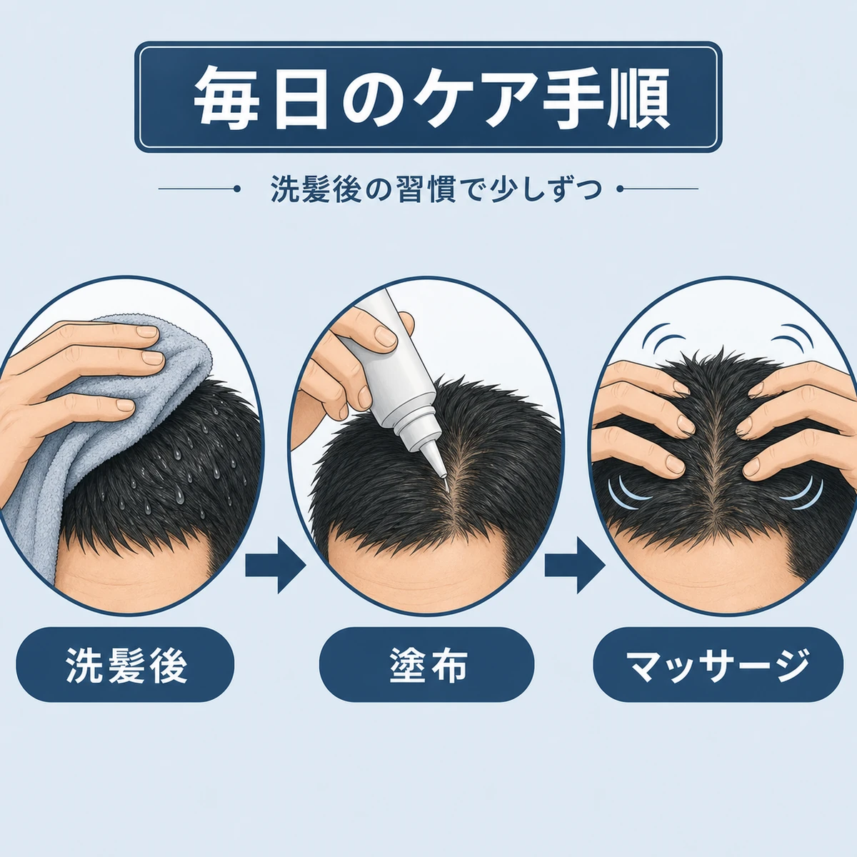 洗髪後から塗布とマッサージまでの育毛剤ケア手順を三段階で表した医療イラスト