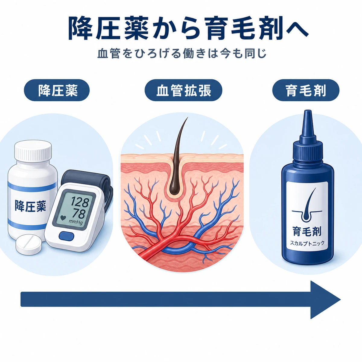 降圧薬から育毛剤へ転用された経緯を左から右の流れで表した医療イラスト