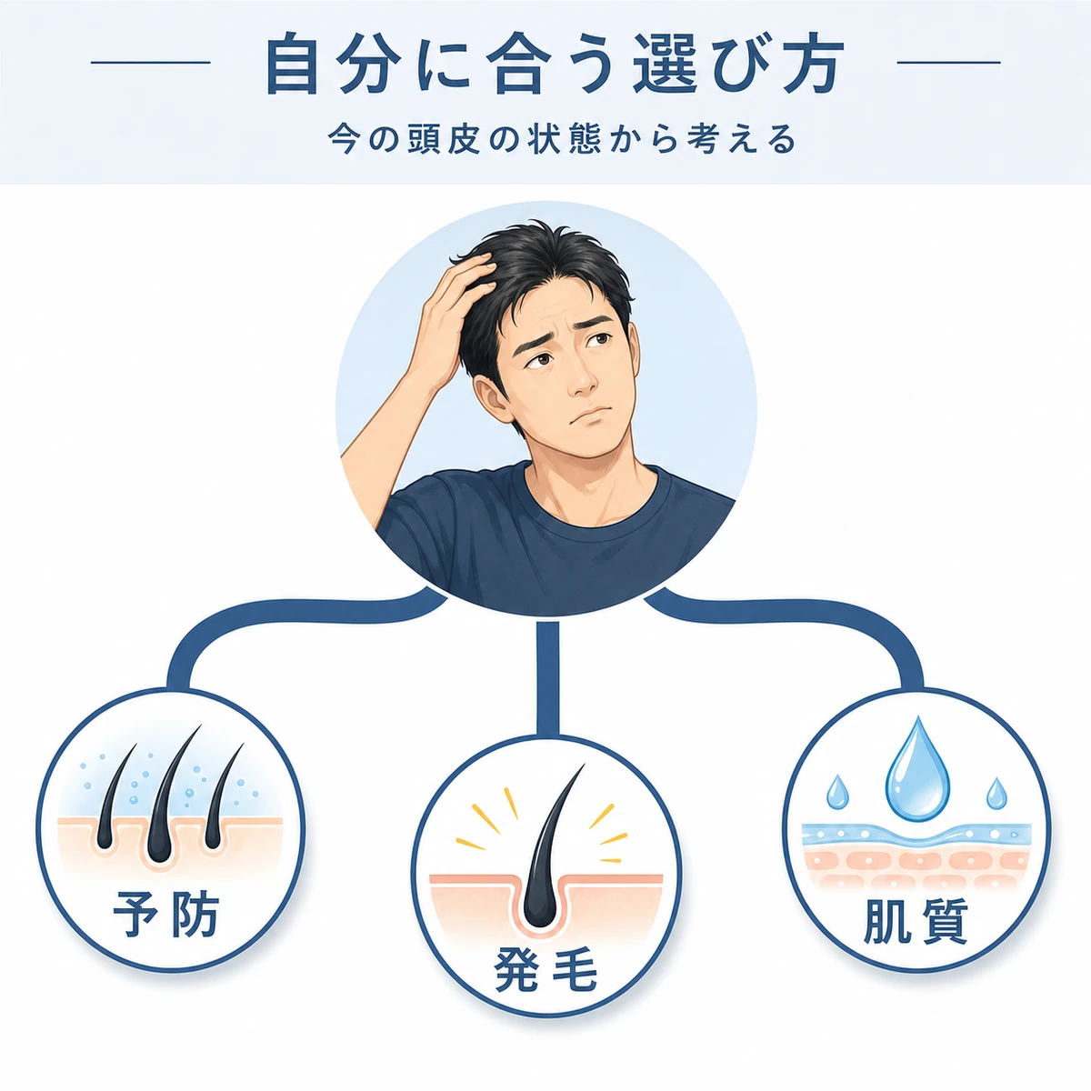 薄毛のタイプや肌質に応じて育毛剤を選び分ける基準を枝分かれで表した医療イラスト