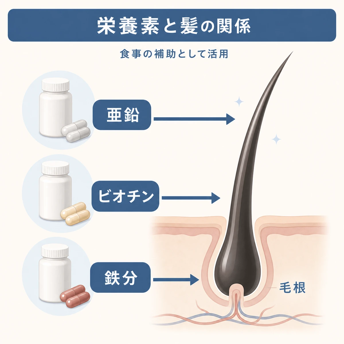 亜鉛やビオチン、鉄分などの栄養素が毛髪や毛根に関わる関係を矢印でつないで表した医療イラスト