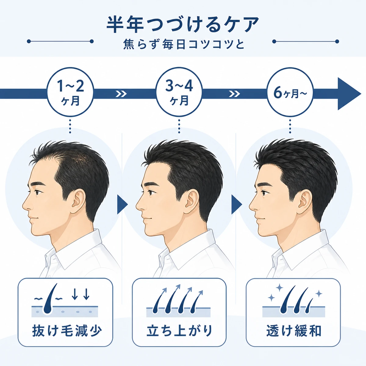 育毛ケアを半年続けたときの段階的な経過の流れを表した医療イラスト