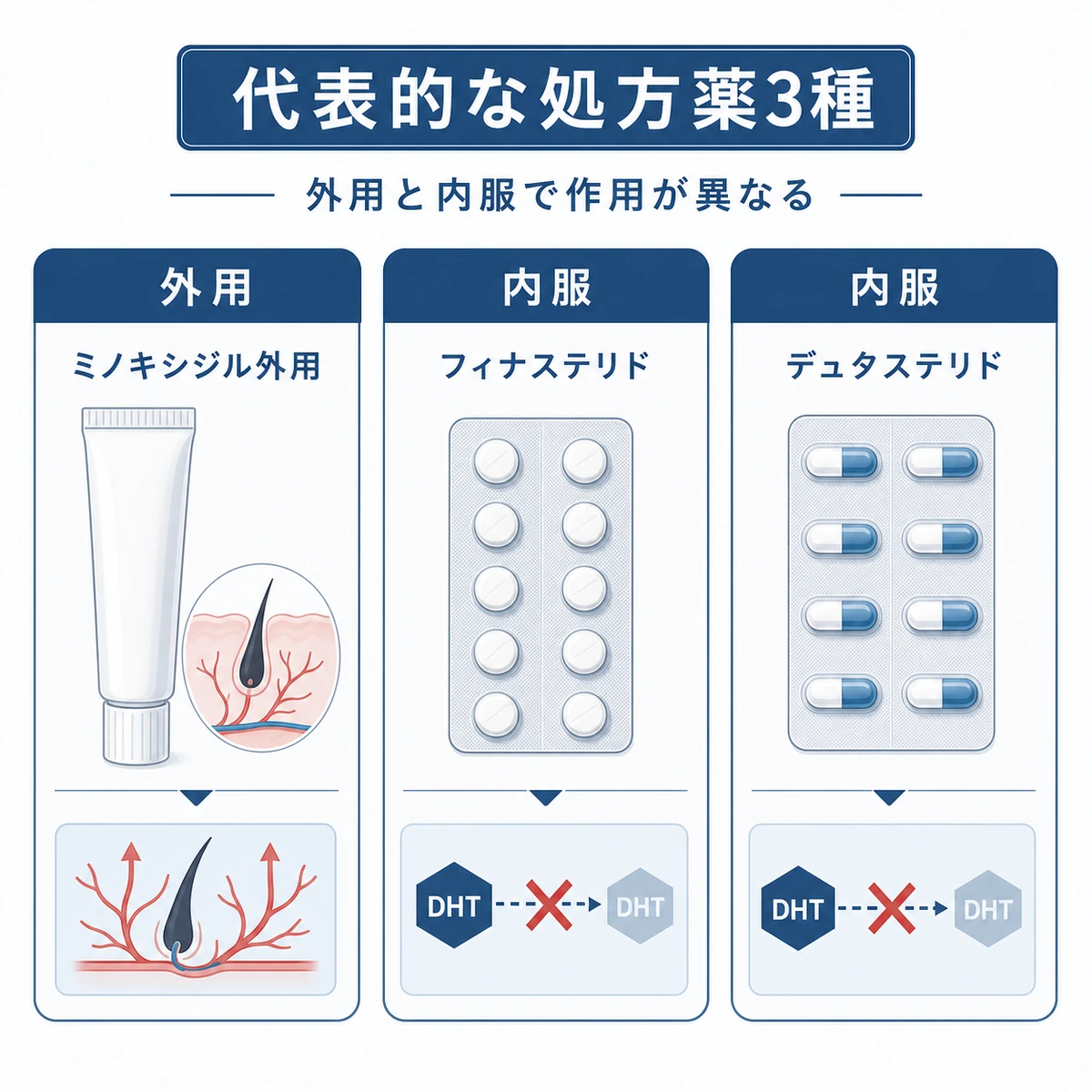 皮膚科で処方される3種類の育毛剤と作用の違いを並べた医療イラスト
