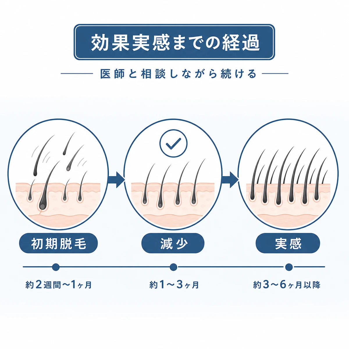 育毛治療の効果を実感するまでの期間の経過を時系列で表した医療イラスト