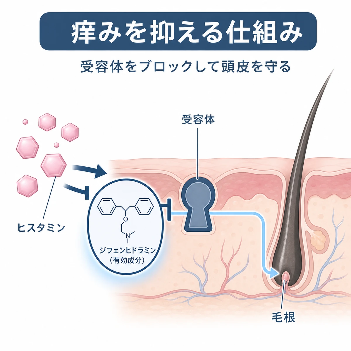 ジフェンヒドラミンがヒスタミン受容体をふさいで頭皮の痒みを抑える仕組みを表した医療イラスト