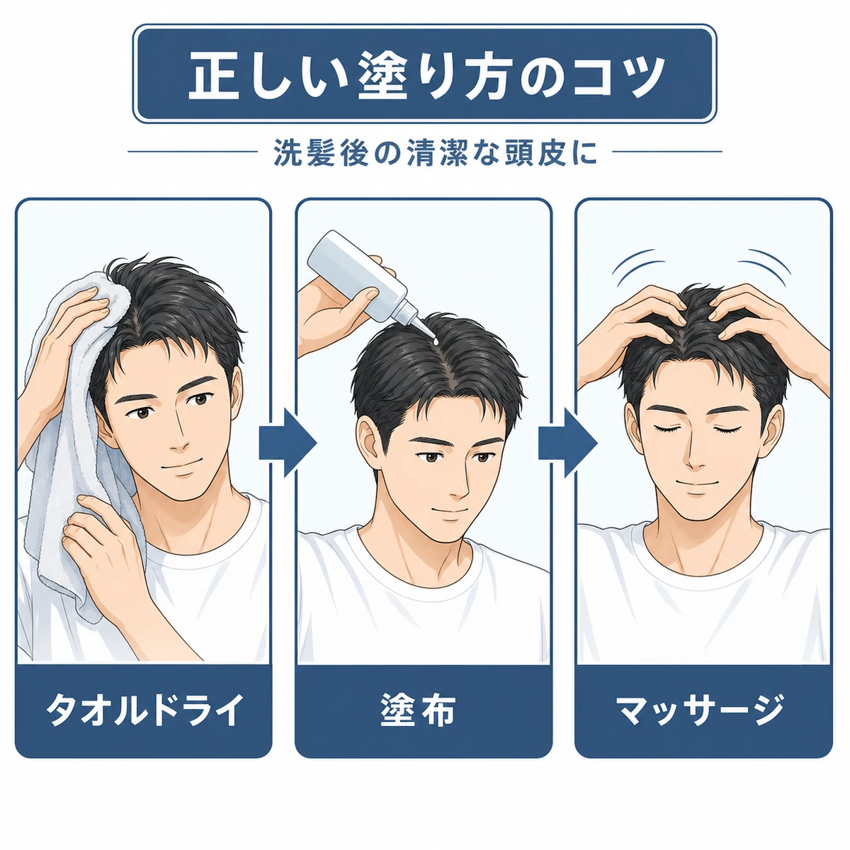 洗髪後にタオルドライして塗布しマッサージするジフェンヒドラミン配合育毛剤の使い方を示した医療イラスト