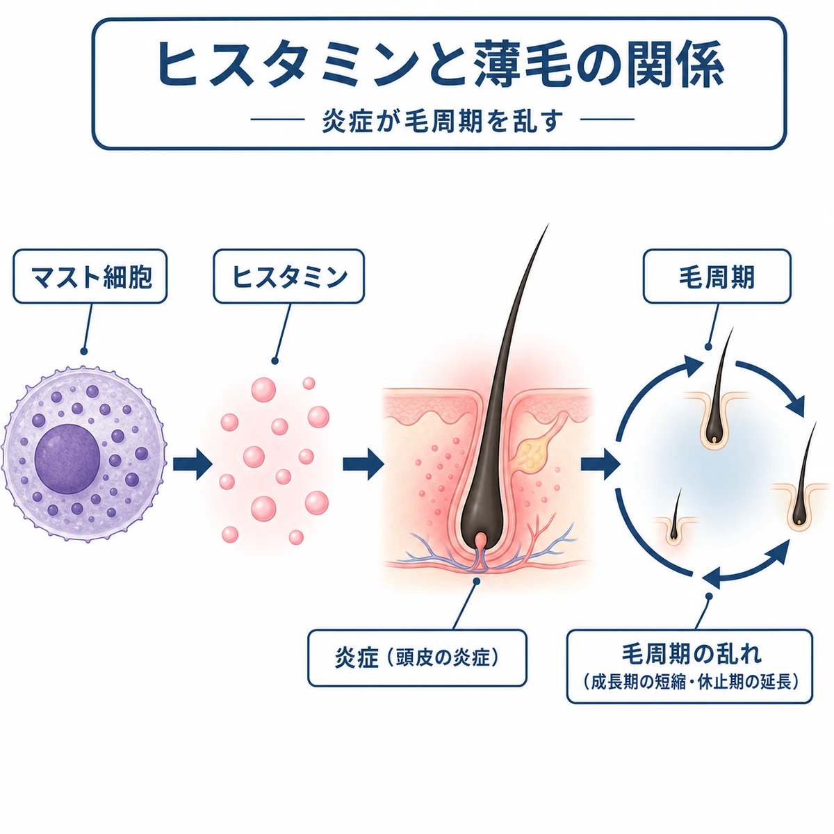 マスト細胞から放出されたヒスタミンが炎症を起こし毛周期を乱す流れを表した医療イラスト