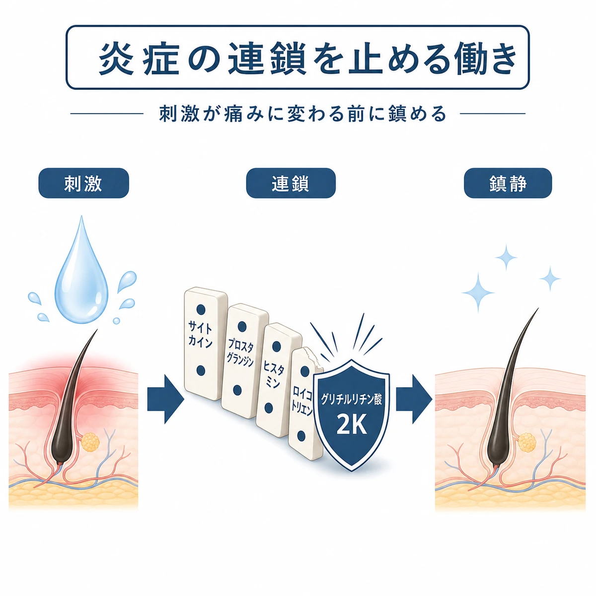 グリチルリチン酸2Kがアルコールによる炎症の連鎖を途中で止める仕組みを段階で表した医療イラスト