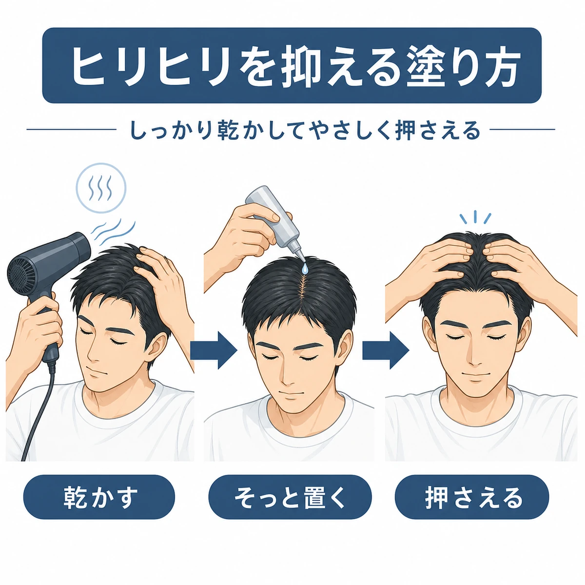 育毛剤の刺激を抑えるために乾かしてやさしく塗る正しい手順を段階で表した医療イラスト