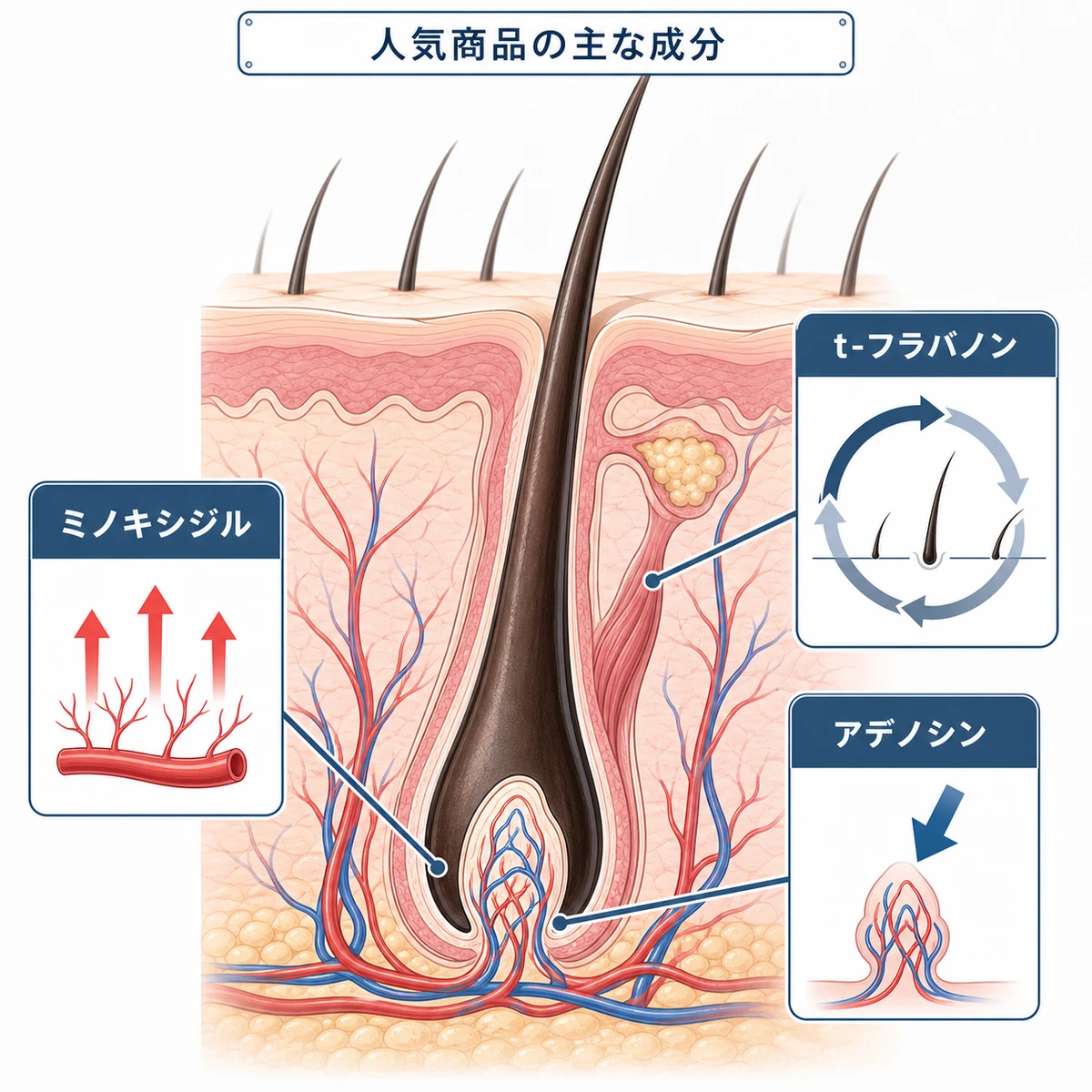 人気の育毛剤に含まれる主な有効成分と毛根への作用を表した医療イラスト