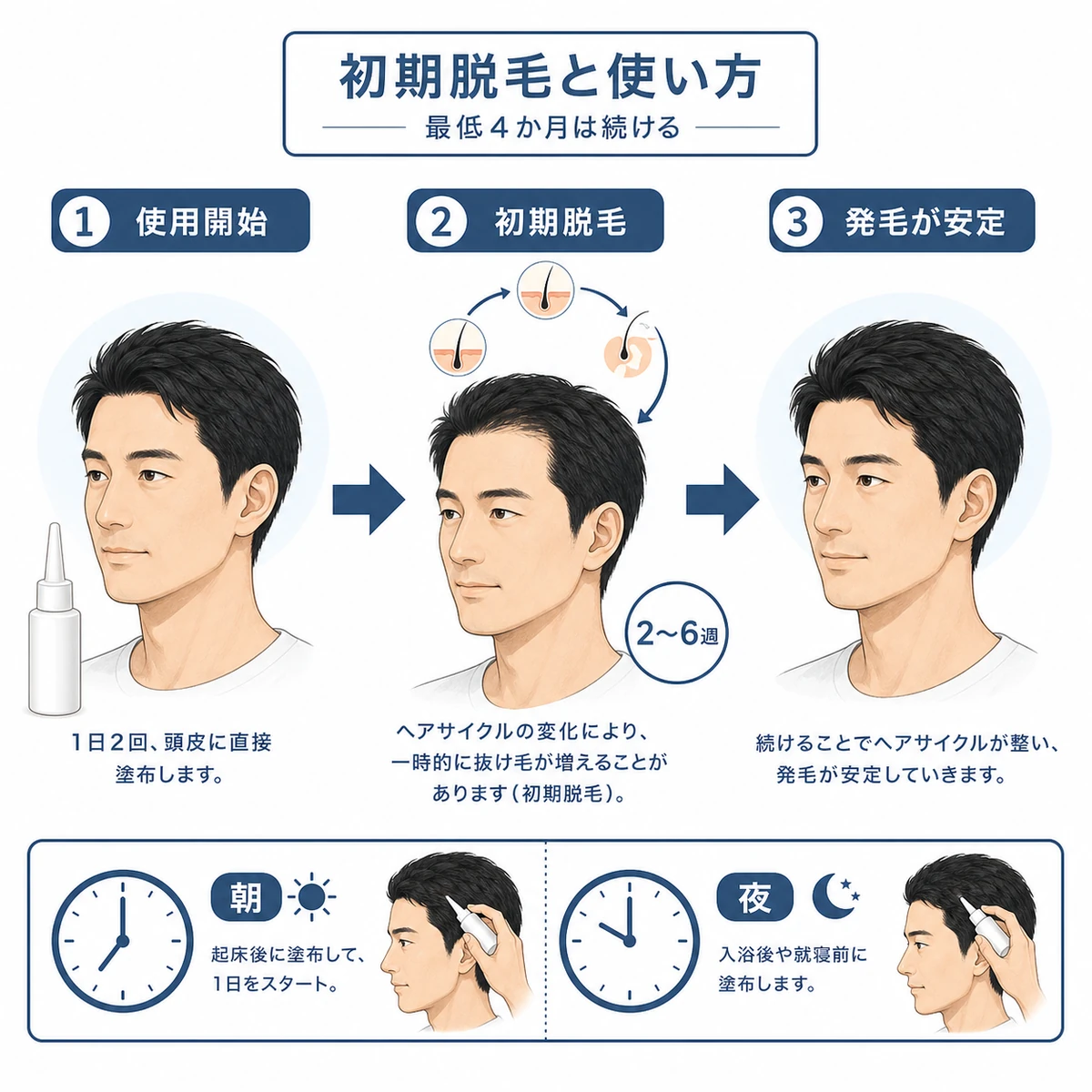 育毛剤の初期脱毛から発毛が安定するまでの経過と塗布方法を表した医療イラスト