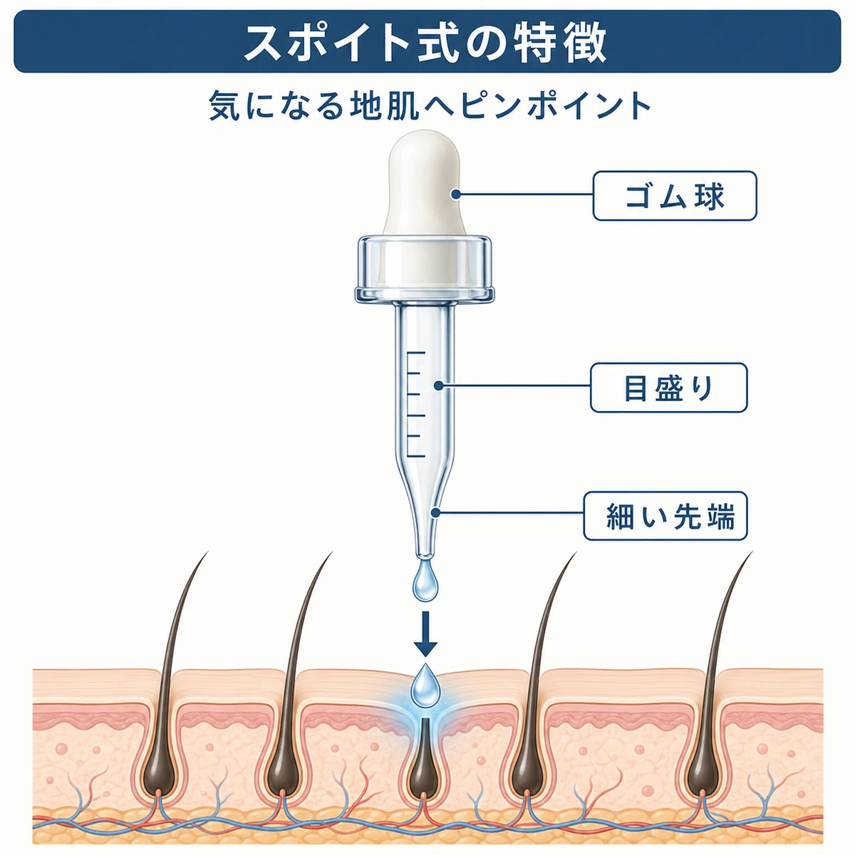 無地スポイト容器の各部と頭皮への滴下方向を表した育毛剤の医療イラスト